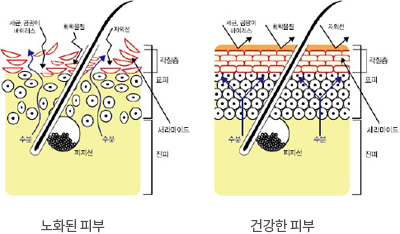 노화된피부, 건강한피부